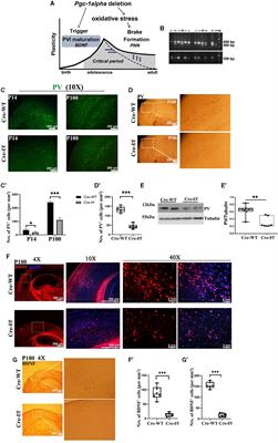 PGC-1α regulates critical period onset/closure, mediating cortical plasticity